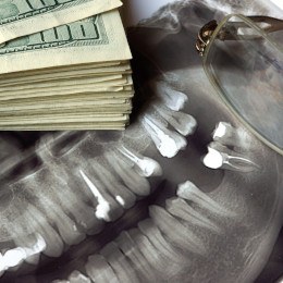 Pile of money on a dental x-ray
