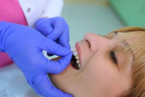 Young woman having veneers attached.