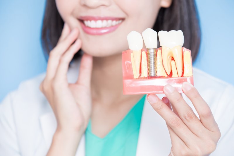 A dentist holding up an enlarged dental implant model